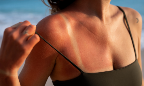 Dicas para um Bronzeamento Artificial Seguro e Natural